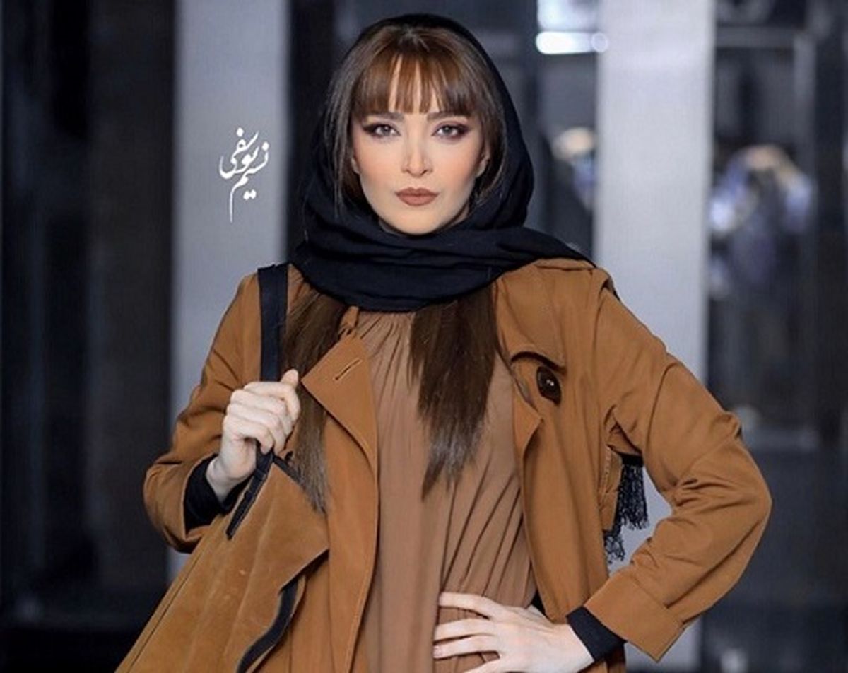 تغییر چهره باورنکردنی بهنوش طباطبایی بعد از عمل! + عکس های داغ