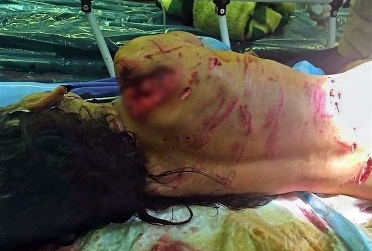 فیلم وحشتناک از حمله سگ های وحشی به دخترک بی نوا + فیلم حاوی صحنه های دلخراش است!